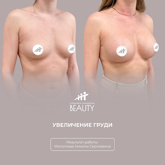 Примеры работ пластического хирурга Молоткова Н.С.