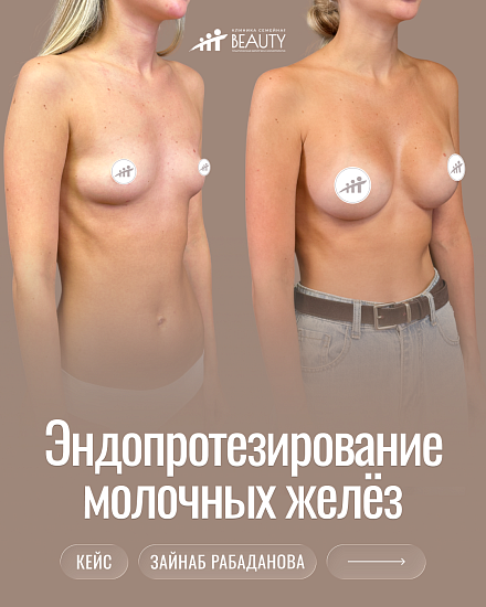 Примеры работ пластического хирурга Рабадановой З.М.