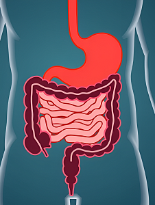 Иссечение дивертикула тонкого кишечника