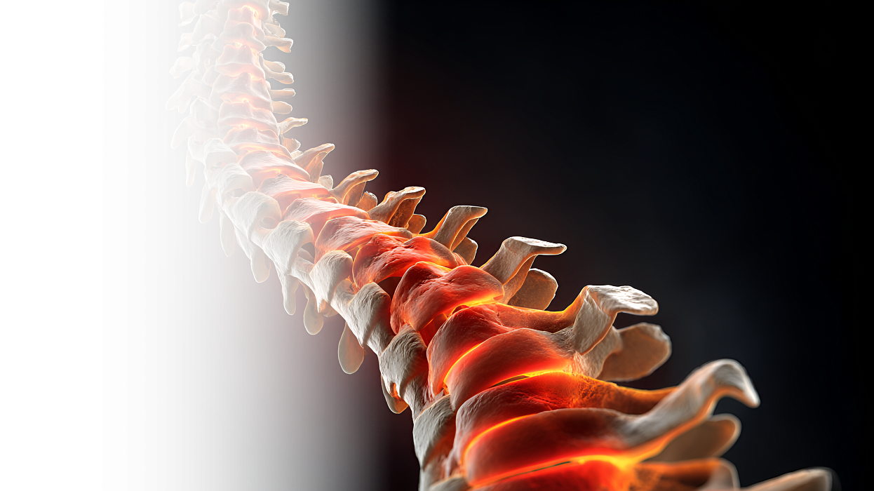 Вертебропластика