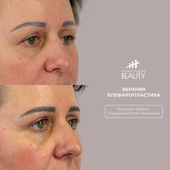 Примеры работ пластического хирурга Старцевой О.И.