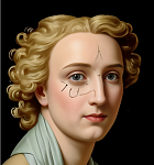 Функциональная септопластика