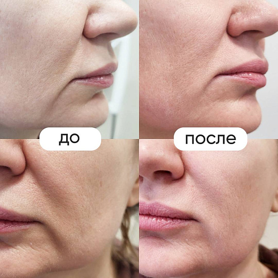 Примеры работ косметолога Юдиной Н.В.