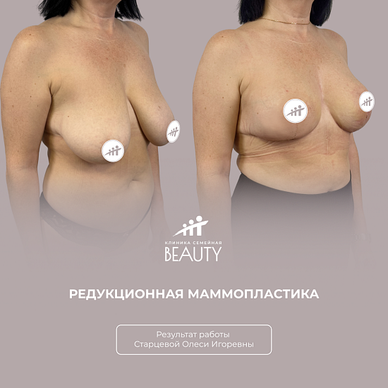 Примеры работ пластического хирурга Старцевой О.И.