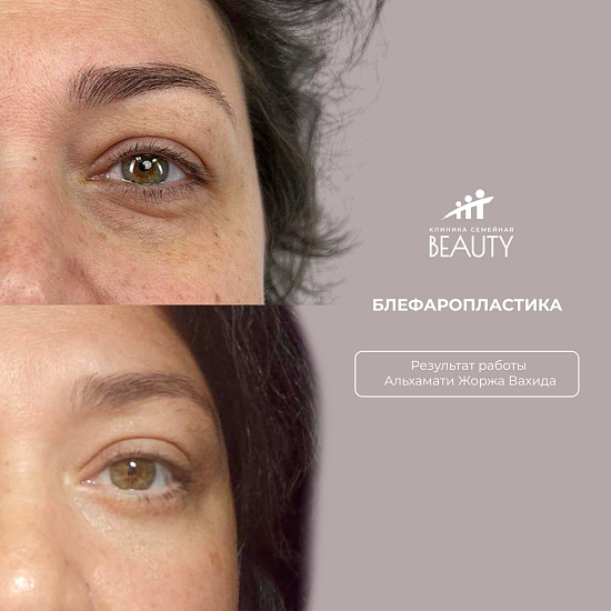 Примеры работ пластического хирурга Альхамати Ж.В.