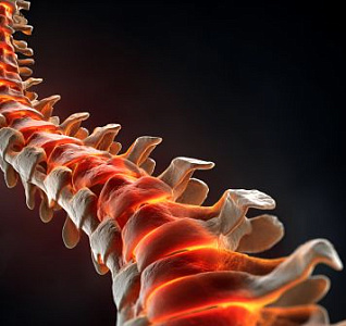 Вертебропластика