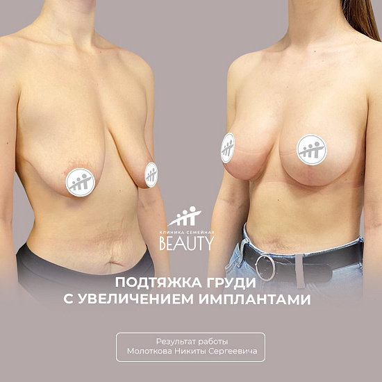 Примеры работ пластического хирурга Молоткова Н.С.