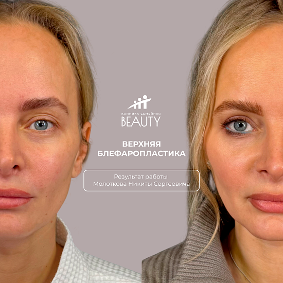 Примеры работ пластического хирурга Молоткова Н.С.