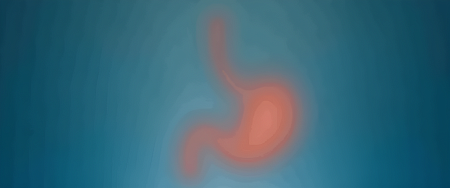 Гастрэктомия