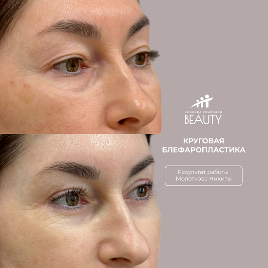 Примеры работ пластического хирурга Молоткова Н.С.