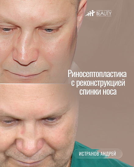 Примеры работ пластического хирурга Истранова А.Л.