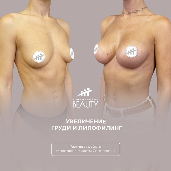 Примеры работ пластического хирурга Молоткова Н.С.