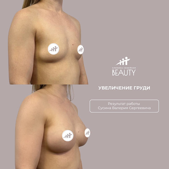 Примеры работ пластического хирурга Сусина В.С.