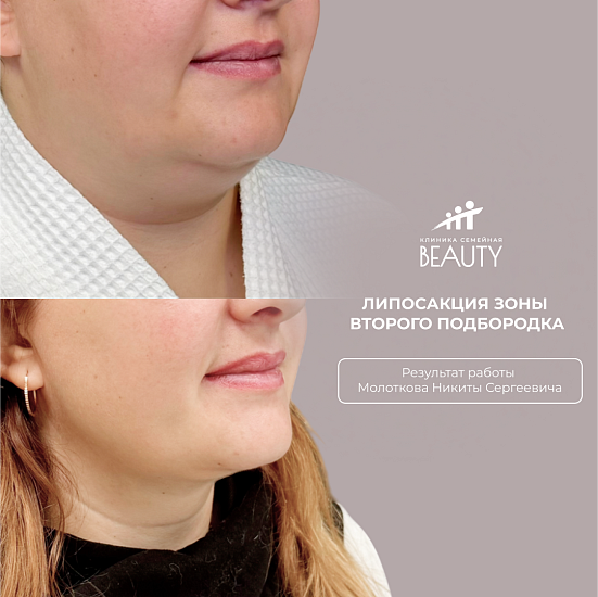 Примеры работ пластического хирурга Молоткова Н.С.