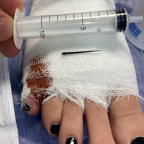 Удар мизинцем о мебель