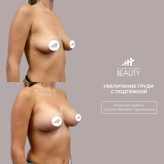 Примеры работ пластического хирурга Сусина В.С.