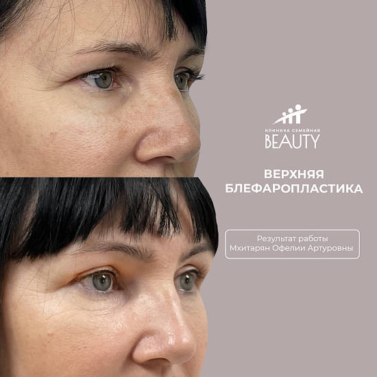 Примеры работ пластического хирурга Мхитарян О.А.