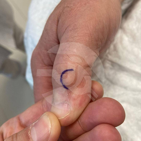 Маленькая шишка - большие неудобства