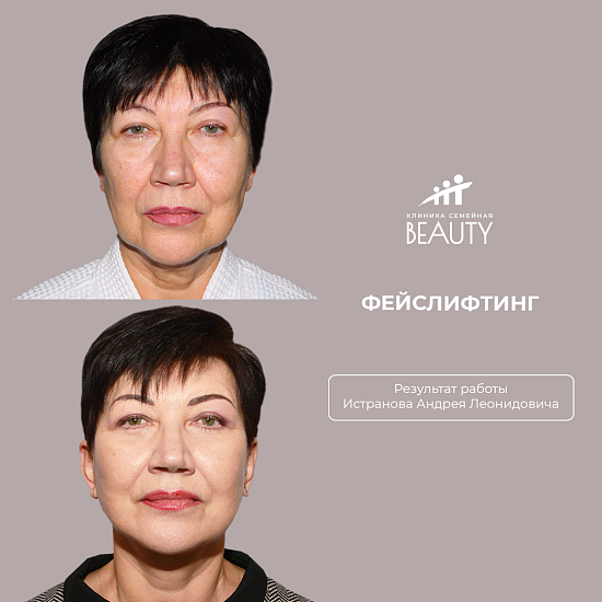 Примеры работ пластического хирурга Истранова А.Л.