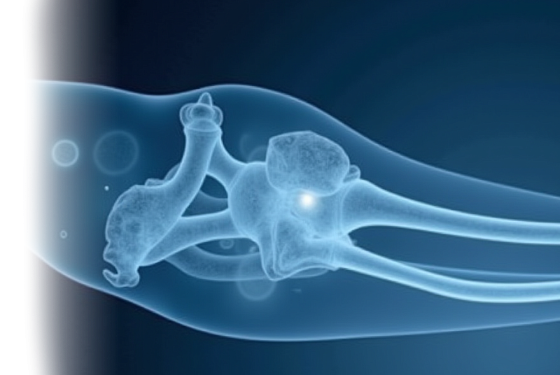 КТ сегмента конечности