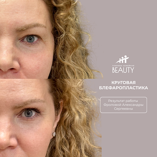 Примеры работ пластического хирурга Фроловой Александры Сергеевны