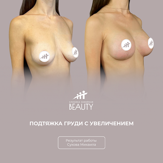 Примеры работ пластического хирурга Сухова М.Н.