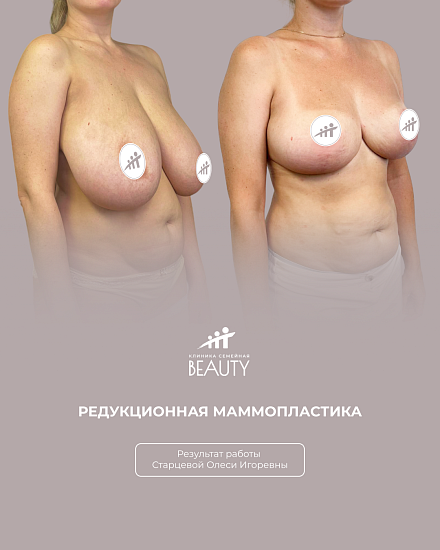 Примеры работ пластического хирурга Старцевой О.И.