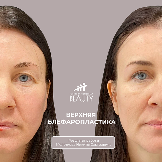 Примеры работ пластического хирурга Молоткова Н.С.