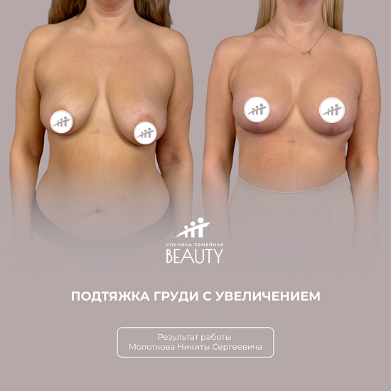 Примеры работ пластического хирурга Молоткова Н.С.