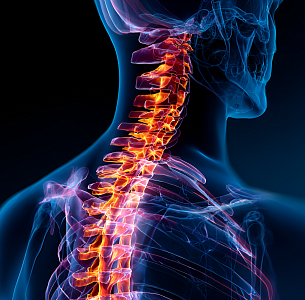 Стабилизация позвоночника на грудном отделе