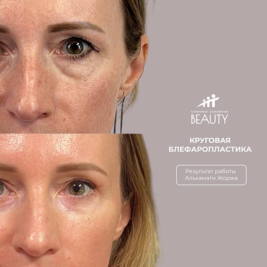 Примеры работ пластического хирурга Альхамати Ж.В.