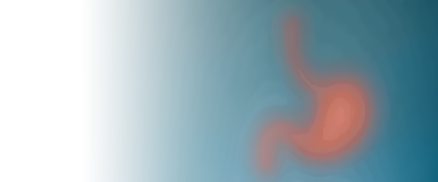 Гастрэктомия