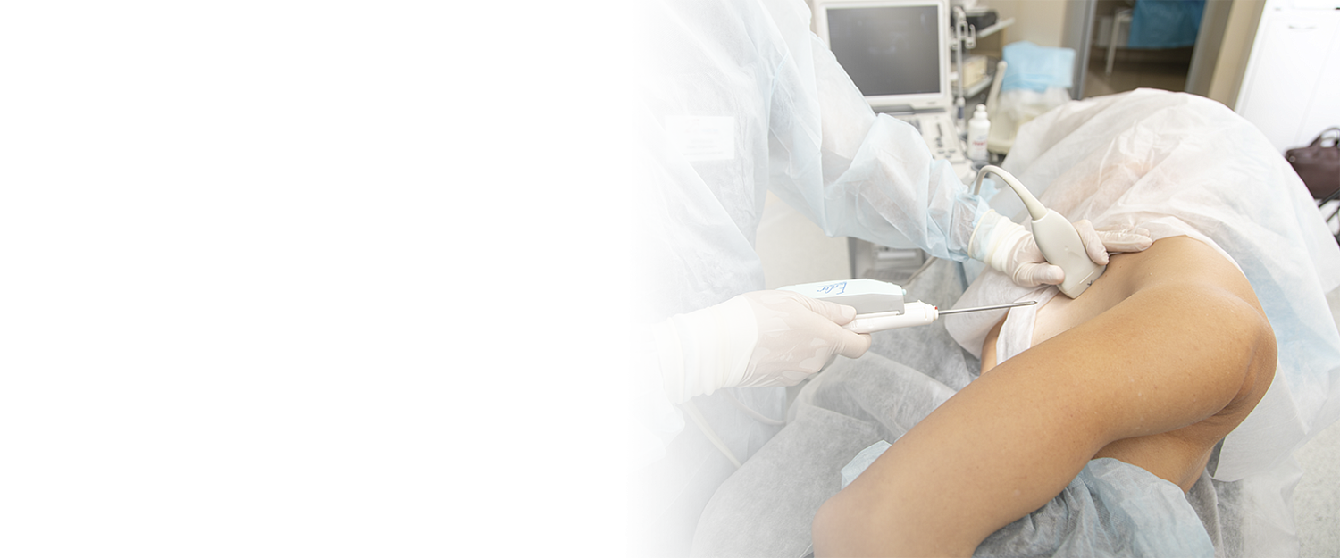 Вакуумная аспирационная биопсия