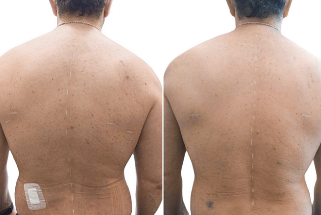 Полный цикл лечения как гарантия результата