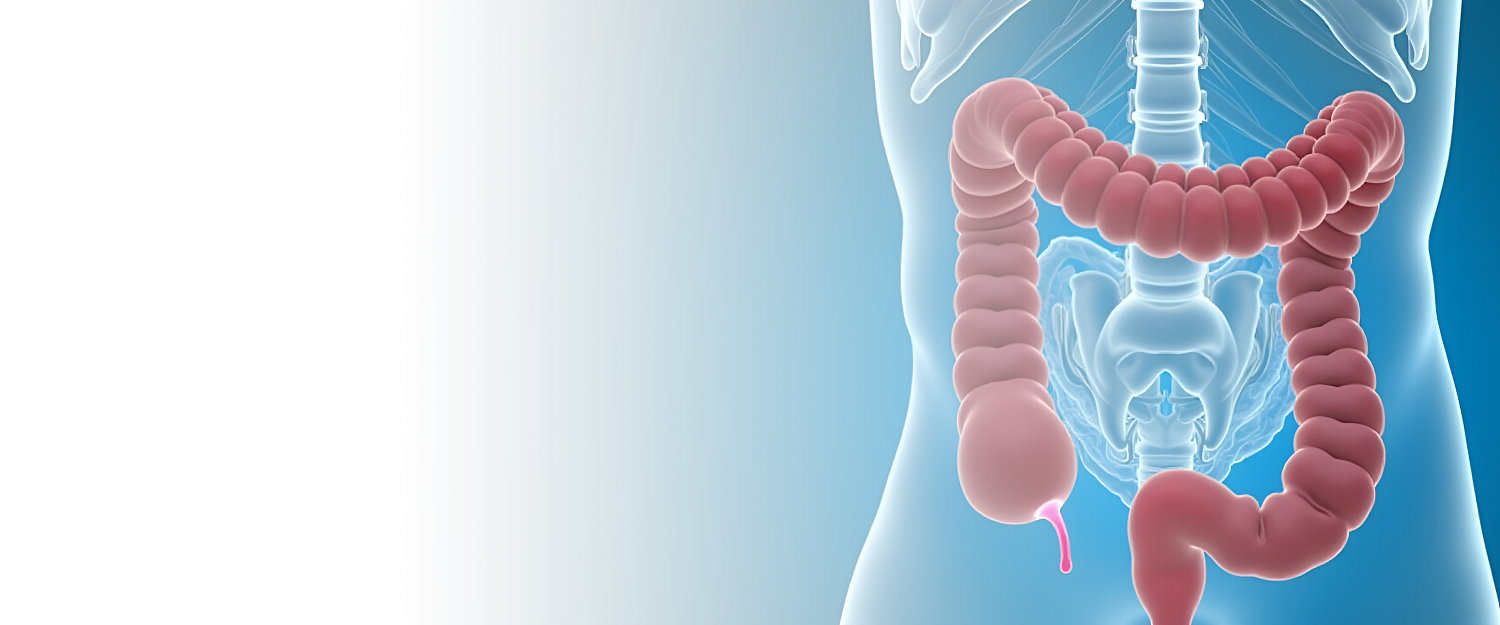 Илеостомия