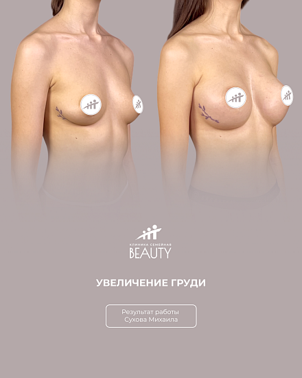 Примеры работ пластического хирурга Сухова М.Н.