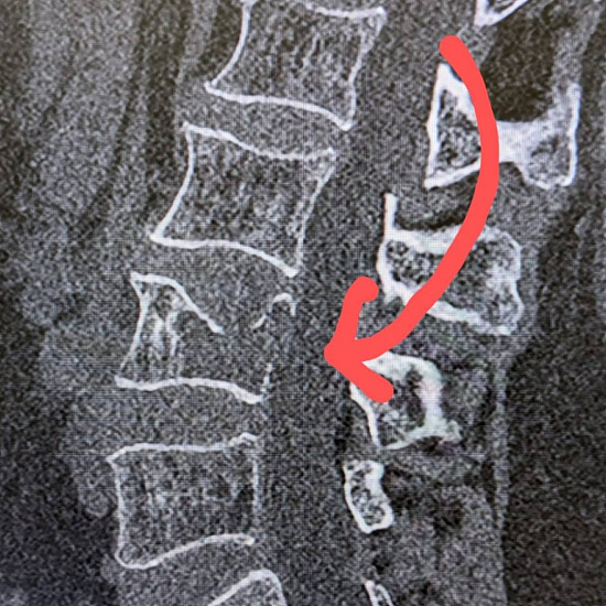 Что скрывают боли в пояснице?