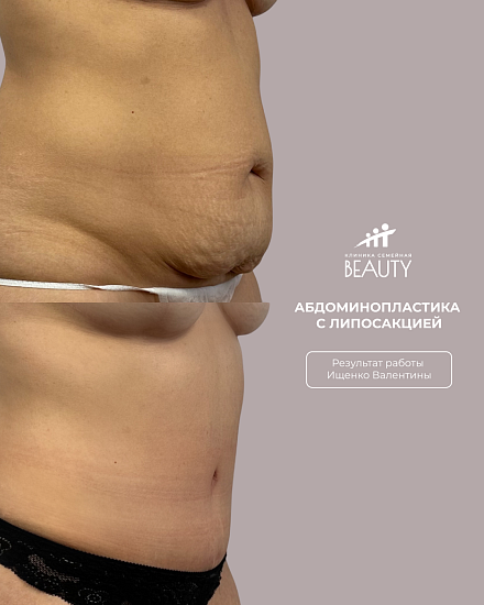 Примеры работ пластического хирурга Ищенко В.И.