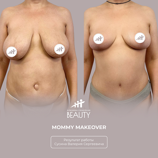 Примеры работ пластического хирурга Сусина В.С.