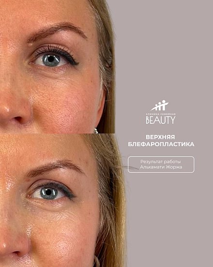 Примеры работ пластического хирурга Альхамати Ж.В.