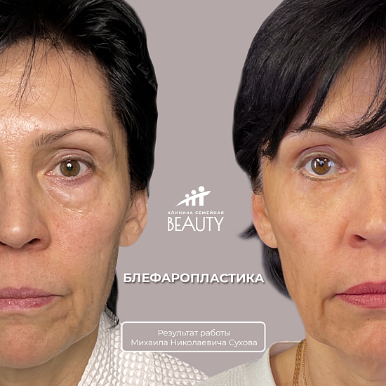 Примеры работ пластического хирурга Сухова М.Н.