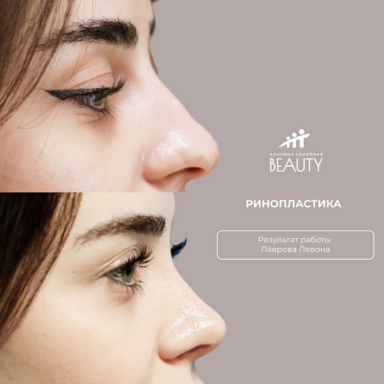 Примеры работ пластического хирурга Лаврова Л.А.