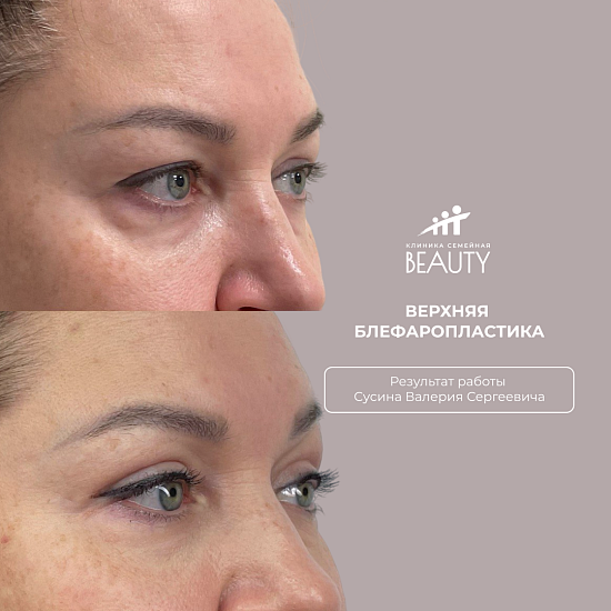 Примеры работ пластического хирурга Сусина В.С.