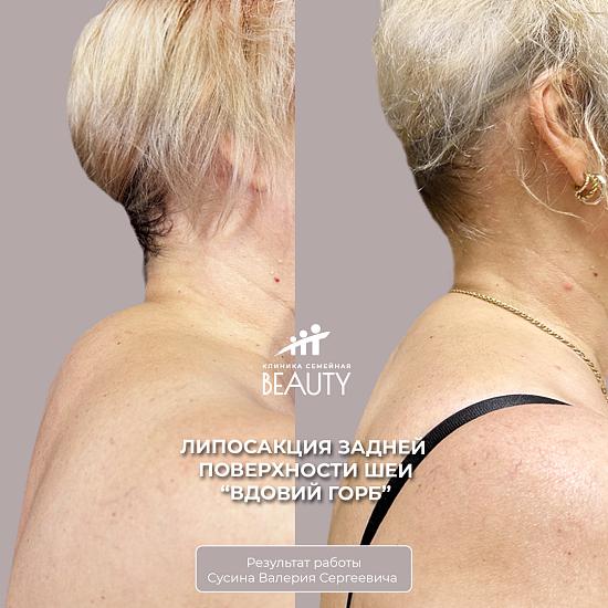 Примеры работ пластического хирурга Сусина В.С.