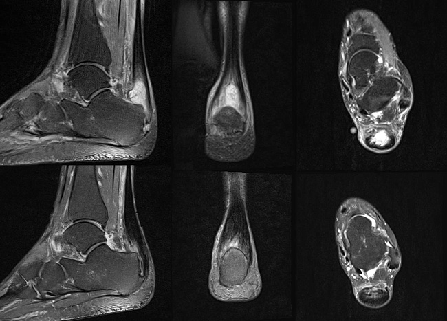 Боль терпеть или купировать
