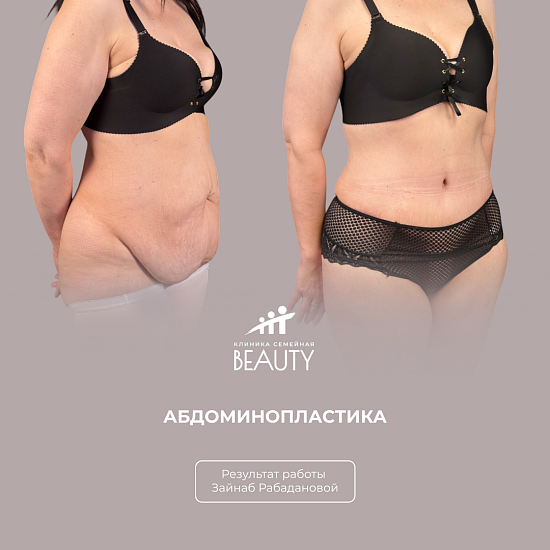 Примеры работ пластического хирурга Рабадановой З.М.