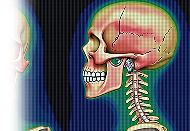 КТ височных костей