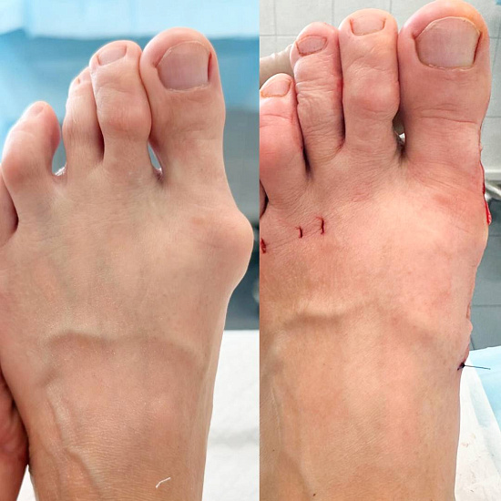 Пучок из пальцев