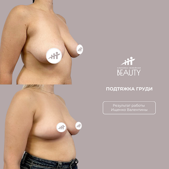 Примеры работ пластического хирурга Ищенко В.И.