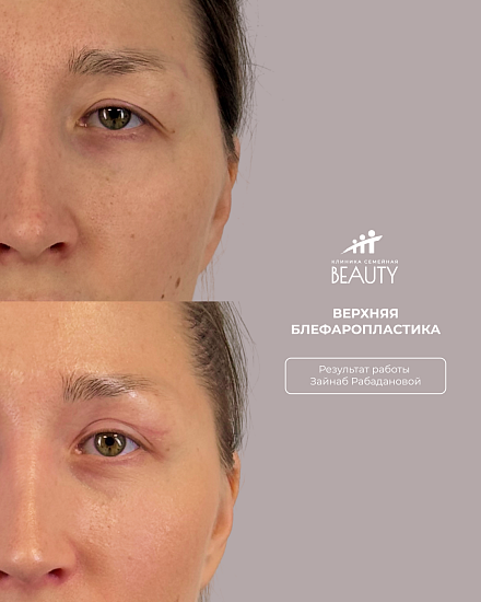 Примеры работ пластического хирурга Рабадановой З.М.